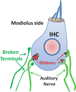 Hearing loss can sometimes be hidden