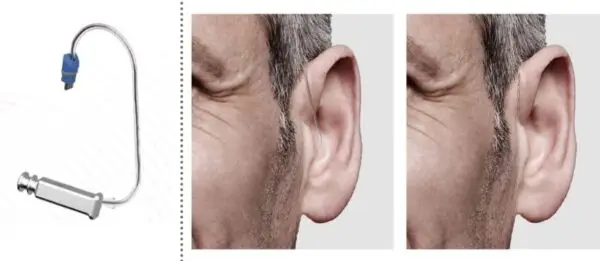 signia pure charge&go ax receiver-in-canal (ric) hearing aids