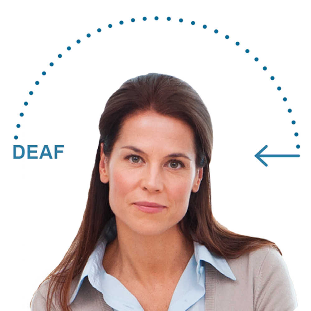 Unilateral Deaf Hearing loss CROS and BiCROS Hearing Aids