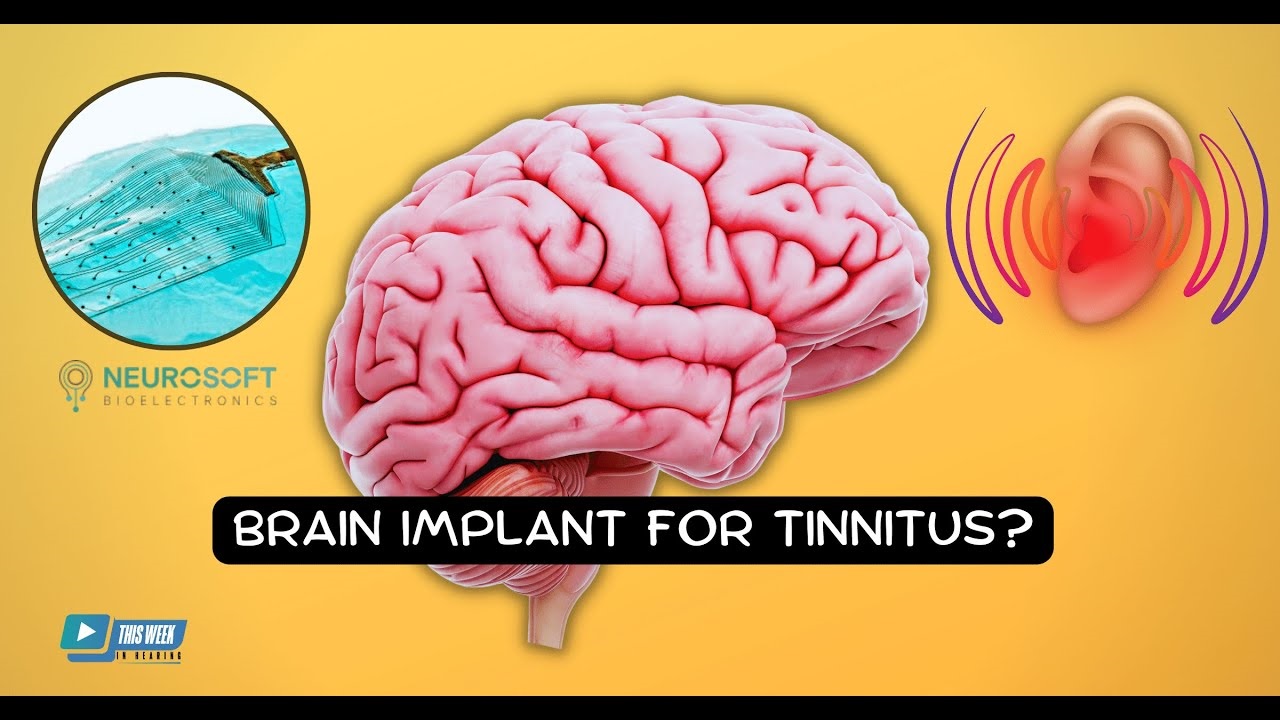 Tinnitus